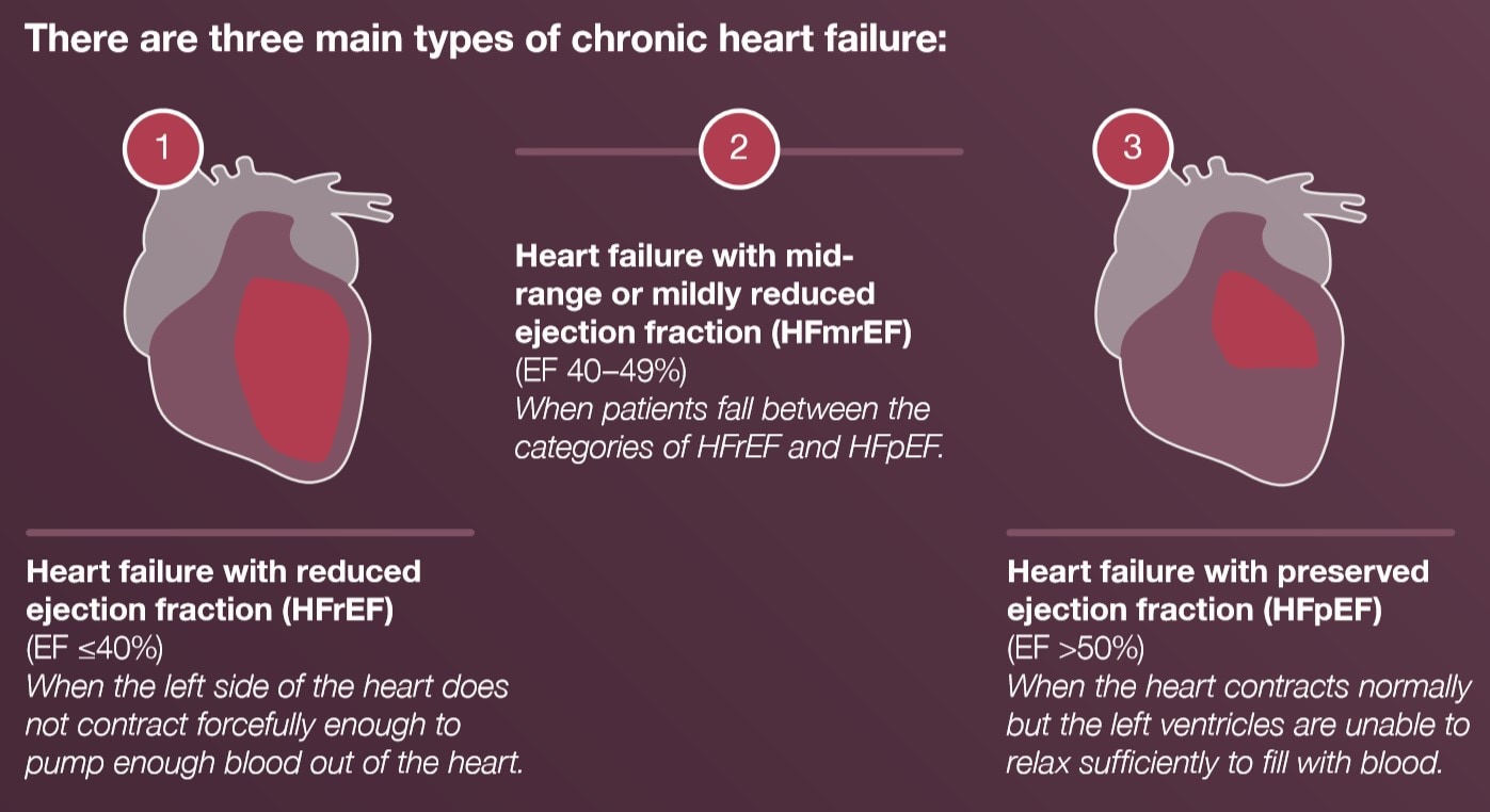 Graphic: Three types of heart failure 