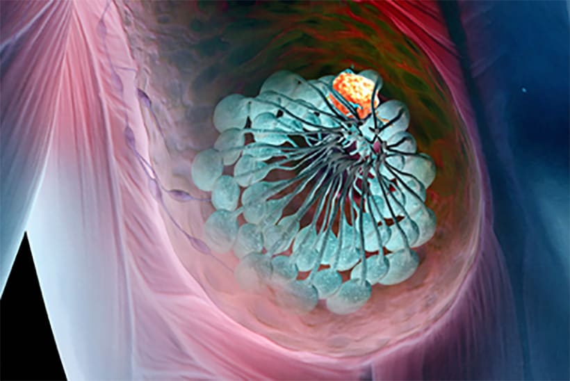 cancermama2820x547