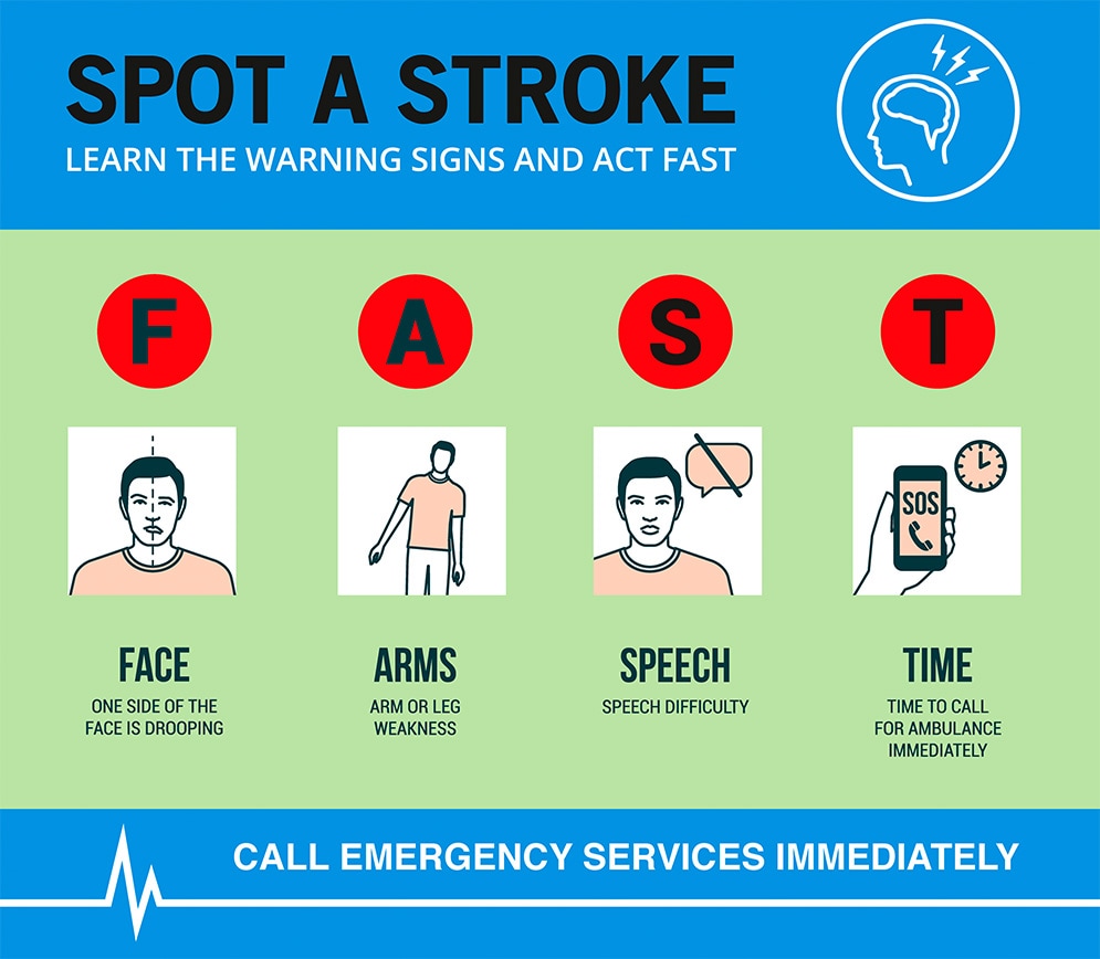 How To Recognize A Stroke | Bayer Global